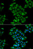 Immunofluorescence analysis of HeLa cells using CTNS antibody (22-534) . Blue: DAPI for nuclear staining.