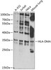 Western blot analysis of extracts of various cell lines, using HLA-DMA antibody (22-557) at 1:1000 dilution.<br/>Secondary antibody: HRP Goat Anti-Rabbit IgG (H+L) at 1:10000 dilution.<br/>Lysates/proteins: 25ug per lane.<br/>Blocking buffer: 3% nonfat dry milk in TBST.<br/>Detection: ECL Basic Kit.<br/>Exposure time: 30s.
