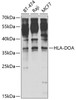 Western blot analysis of extracts of various cell lines, using HLA-DOA antibody (22-558) at 1:1000 dilution.<br/>Secondary antibody: HRP Goat Anti-Rabbit IgG (H+L) at 1:10000 dilution.<br/>Lysates/proteins: 25ug per lane.<br/>Blocking buffer: 3% nonfat dry milk in TBST.<br/>Detection: ECL Enhanced Kit.<br/>Exposure time: 5s.