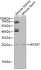 Western blot analysis of extracts of various cell lines, using HOXB7 antibody (22-559) at 1:1000 dilution._Secondary antibody: HRP Goat Anti-Rabbit IgG (H+L) at 1:10000 dilution._Lysates/proteins: 25ug per lane._Blocking buffer: 3% nonfat dry milk in TBST._Detection: ECL Enhanced Kit._Exposure time: 15s.