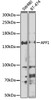 Western blot analysis of extracts of various cell lines, using AFF1 antibody (22-565) at 1:1000 dilution.<br/>Secondary antibody: HRP Goat Anti-Rabbit IgG (H+L) at 1:10000 dilution.<br/>Lysates/proteins: 25ug per lane.<br/>Blocking buffer: 3% nonfat dry milk in TBST.<br/>Detection: ECL Enhanced Kit.<br/>Exposure time: 30s.