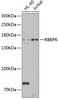 Western blot analysis of extracts of various cell lines, using RBBP6 antibody (22-593) at 1:1000 dilution.<br/>Secondary antibody: HRP Goat Anti-Rabbit IgG (H+L) at 1:10000 dilution.<br/>Lysates/proteins: 25ug per lane.<br/>Blocking buffer: 3% nonfat dry milk in TBST.<br/>Detection: ECL Basic Kit.<br/>Exposure time: 90s.