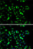 Immunofluorescence analysis of A-549 cells using RBBP6 antibody (22-593) . Blue: DAPI for nuclear staining.
