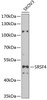 Western blot analysis of extracts of SKOV3 cells, using SRSF4 antibody (22-601) at 1:1000 dilution.<br/>Secondary antibody: HRP Goat Anti-Rabbit IgG (H+L) at 1:10000 dilution.<br/>Lysates/proteins: 25ug per lane.<br/>Blocking buffer: 3% nonfat dry milk in TBST.<br/>Detection: ECL Basic Kit.<br/>Exposure time: 90s.