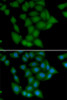 Immunofluorescence analysis of U2OS cells using CAMK1 antibody (22-635) . Blue: DAPI for nuclear staining.