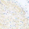 Immunohistochemistry of paraffin-embedded human liver using BRD9 antibody (22-728) at dilution of 1:200 (40x lens) .