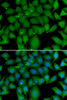 Immunofluorescence analysis of A549 cells using BCL2L15 antibody (22-746) . Blue: DAPI for nuclear staining.