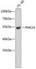 Western blot analysis of extracts of HL-60 cells, using PI4K2A antibody (22-754) .<br/>Secondary antibody: HRP Goat Anti-Rabbit IgG (H+L) at 1:10000 dilution.<br/>Lysates/proteins: 25ug per lane.<br/>Blocking buffer: 3% nonfat dry milk in TBST.