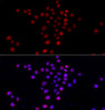 Immunofluorescence analysis of HeLa cells using PI4K2A antibody (22-754) . Blue: DAPI for nuclear staining.