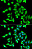 Immunofluorescence analysis of A549 cells using GSTCD antibody (22-767) . Blue: DAPI for nuclear staining.
