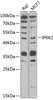 Western blot analysis of extracts of various cell lines, using IP6K2 antibody (22-771) at 1:1000 dilution.<br/>Secondary antibody: HRP Goat Anti-Rabbit IgG (H+L) at 1:10000 dilution.<br/>Lysates/proteins: 25ug per lane.<br/>Blocking buffer: 3% nonfat dry milk in TBST.<br/>Detection: ECL Basic Kit.<br/>Exposure time: 60s.