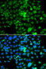 Immunofluorescence analysis of A549 cells using NAP1L3 antibody (22-779) . Blue: DAPI for nuclear staining.