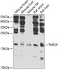 Western blot analysis of extracts of various cell lines, using THRSP antibody (22-800) at 1:1000 dilution._Secondary antibody: HRP Goat Anti-Rabbit IgG (H+L) at 1:10000 dilution._Lysates/proteins: 25ug per lane._Blocking buffer: 3% nonfat dry milk in TBST._Detection: ECL Enhanced Kit._Exposure time: 60s.