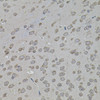 Immunohistochemistry of paraffin-embedded mouse brain using ATF4 antibody (22-803) (40x lens) .