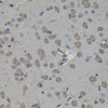 Immunohistochemistry of paraffin-embedded rat brain using ATF4 antibody (22-803) (40x lens) .