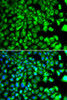 Immunofluorescence analysis of MCF-7 cells using C10orf32 antibody (22-829) . Blue: DAPI for nuclear staining.