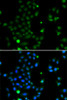 Immunofluorescence analysis of MCF-7 cells using GCM1 antibody (22-833) . Blue: DAPI for nuclear staining.
