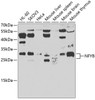 Western blot analysis of extracts of various cell lines, using NFYB antibody (22-843) at 1:500 dilution.<br/>Secondary antibody: HRP Goat Anti-Rabbit IgG (H+L) at 1:10000 dilution.<br/>Lysates/proteins: 25ug per lane.<br/>Blocking buffer: 3% nonfat dry milk in TBST.<br/>Detection: ECL Basic Kit.<br/>Exposure time: 90s.