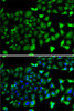 Immunofluorescence analysis of A-549 cells using NFYB antibody (22-843) . Blue: DAPI for nuclear staining.