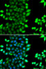 Immunofluorescence analysis of MCF-7 cells using RNF7 antibody (22-847) . Blue: DAPI for nuclear staining.