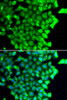 Immunofluorescence analysis of MCF-7 cells using TRIAP1 antibody (22-855) . Blue: DAPI for nuclear staining.