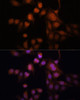 Immunofluorescence analysis of HeLa cells using TWIST1 antibody (22-856) at dilution of 1:100. Blue: DAPI for nuclear staining.