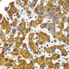 Immunohistochemistry of paraffin-embedded human liver damage using SMAD9 antibody (23-001) at dilution of 1:100 (40x lens) .