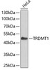 Western blot analysis of extracts of HeLa cells, using TRDMT1 antibody (23-015) .<br/>Secondary antibody: HRP Goat Anti-Rabbit IgG (H+L) at 1:10000 dilution.<br/>Lysates/proteins: 25ug per lane.<br/>Blocking buffer: 3% nonfat dry milk in TBST.