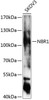 Western blot analysis of extracts of SKOV3 cells, using NBR1 antibody (23-029) at 1:1000 dilution._Secondary antibody: HRP Goat Anti-Rabbit IgG (H+L) at 1:10000 dilution._Lysates/proteins: 25ug per lane._Blocking buffer: 3% nonfat dry milk in TBST._Detection: ECL Enhanced Kit._Exposure time: 90s.
