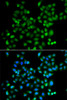 Immunofluorescence analysis of A549 cells using ZSCAN26 antibody (23-034) . Blue: DAPI for nuclear staining.