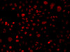 Immunofluorescence analysis of A549 cells using ARID1A antibody (23-052) .