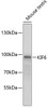 Western blot analysis of extracts of mouse testis, using KIF6 antibody (23-056) at 1:1000 dilution.<br/>Secondary antibody: HRP Goat Anti-Rabbit IgG (H+L) at 1:10000 dilution.<br/>Lysates/proteins: 25ug per lane.<br/>Blocking buffer: 3% nonfat dry milk in TBST.<br/>Detection: ECL Basic Kit.<br/>Exposure time: 90s.