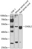 Western blot analysis of extracts of various cell lines, using CHI3L2 antibody (23-084) at 1:1000 dilution._Secondary antibody: HRP Goat Anti-Rabbit IgG (H+L) at 1:10000 dilution._Lysates/proteins: 25ug per lane._Blocking buffer: 3% nonfat dry milk in TBST._Detection: ECL Basic Kit._Exposure time: 90s.