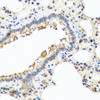 Immunohistochemistry of paraffin-embedded rat lung using CHI3L2 antibody (23-084) at dilution of 1:100 (40x lens) .
