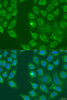 Immunofluorescence analysis of U2OS cells using HSD17B3 antibody (23-107) at dilution of 1:100. Blue: DAPI for nuclear staining.