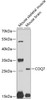 Western blot analysis of extracts of various cell lines, using COQ7 antibody (23-170) at 1:1000 dilution._Secondary antibody: HRP Goat Anti-Rabbit IgG (H+L) at 1:10000 dilution._Lysates/proteins: 25ug per lane._Blocking buffer: 3% nonfat dry milk in TBST._Detection: ECL Enhanced Kit._Exposure time: 30s.