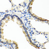 Immunohistochemistry of paraffin-embedded rat lung using ANGPT1 antibody (23-247) at dilution of 1:100 (40x lens) .