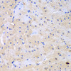 Immunohistochemistry of paraffin-embedded mouse heart using ARHGEF9 antibody (23-314) at dilution of 1:100 (40x lens) .
