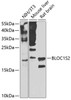 Western blot analysis of extracts of various cell lines, using BLOC1S2 antibody (23-347) at 1:1000 dilution._Secondary antibody: HRP Goat Anti-Rabbit IgG (H+L) at 1:10000 dilution._Lysates/proteins: 25ug per lane._Blocking buffer: 3% nonfat dry milk in TBST._Detection: ECL Enhanced Kit._Exposure time: 30s.