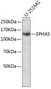 Western blot analysis of extracts of U-251MG cells, using EPHA5 antibody (23-361) .<br/>Secondary antibody: HRP Goat Anti-Mouse IgG (H+L) (AS003) at 1:10000 dilution.<br/>Lysates/proteins: 25ug per lane.<br/>Blocking buffer: 3% nonfat dry milk in TBST.