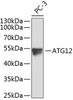 Western blot analysis of extracts of PC-3 cells, using ATG12 antibody (23-385) .<br/>Secondary antibody: HRP Goat Anti-Mouse IgG (H+L) (AS003) at 1:10000 dilution.<br/>Lysates/proteins: 25ug per lane.<br/>Blocking buffer: 3% nonfat dry milk in TBST.