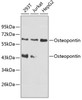 Western blot analysis of extracts of various cell lines, using Osteopontin antibody (23-388) .<br/>Secondary antibody: HRP Goat Anti-Rabbit IgG (H+L) at 1:10000 dilution.<br/>Lysates/proteins: 25ug per lane.<br/>Blocking buffer: 3% nonfat dry milk in TBST.