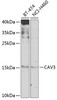 Western blot analysis of extracts of various cell lines, using CAV3 antibody (23-393) at 1:1000 dilution._Secondary antibody: HRP Goat Anti-Rabbit IgG (H+L) at 1:10000 dilution._Lysates/proteins: 25ug per lane._Blocking buffer: 3% nonfat dry milk in TBST._Detection: ECL Enhanced Kit._Exposure time: 60s.