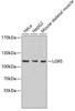 Western blot analysis of extracts of various cell lines, using LGR5 antibody (23-394) .<br/>Secondary antibody: HRP Goat Anti-Rabbit IgG (H+L) at 1:10000 dilution.<br/>Lysates/proteins: 25ug per lane.<br/>Blocking buffer: 3% nonfat dry milk in TBST.