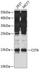 Western blot analysis of extracts of various cell lines, using CST6 antibody (23-411) at 1:1000 dilution._Secondary antibody: HRP Goat Anti-Rabbit IgG (H+L) at 1:10000 dilution._Lysates/proteins: 25ug per lane._Blocking buffer: 3% nonfat dry milk in TBST._Detection: ECL Enhanced Kit._Exposure time: 90s.
