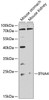 Western blot analysis of extracts of various cell lines, using IFNA4 antibody (23-416) at 1:1000 dilution.<br/>Secondary antibody: HRP Goat Anti-Rabbit IgG (H+L) at 1:10000 dilution.<br/>Lysates/proteins: 25ug per lane.<br/>Blocking buffer: 3% nonfat dry milk in TBST.<br/>Detection: ECL Enhanced Kit.<br/>Exposure time: 20s.