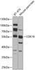 Western blot analysis of extracts of various cell lines, using CDK16 antibody (23-427) at 1:1000 dilution.<br/>Secondary antibody: HRP Goat Anti-Rabbit IgG (H+L) at 1:10000 dilution.<br/>Lysates/proteins: 25ug per lane.<br/>Blocking buffer: 3% nonfat dry milk in TBST.<br/>Detection: ECL Basic Kit.<br/>Exposure time: 30s.