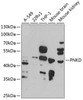 Western blot analysis of extracts of various cell lines, using PNKD antibody (23-460) at 1:1000 dilution.<br/>Secondary antibody: HRP Goat Anti-Rabbit IgG (H+L) at 1:10000 dilution.<br/>Lysates/proteins: 25ug per lane.<br/>Blocking buffer: 3% nonfat dry milk in TBST.<br/>Detection: ECL Basic Kit.<br/>Exposure time: 90s.