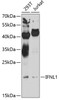 Western blot analysis of extracts of various cell lines, using IFNL1 antibody (23-491) at 1:1000 dilution._Secondary antibody: HRP Goat Anti-Rabbit IgG (H+L) at 1:10000 dilution._Lysates/proteins: 25ug per lane._Blocking buffer: 3% nonfat dry milk in TBST._Detection: ECL Enhanced Kit._Exposure time: 20s.