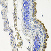 Immunohistochemistry of paraffin-embedded mouse lung using MARK1 antibody (23-581) at dilution of 1:100 (40x lens) .
